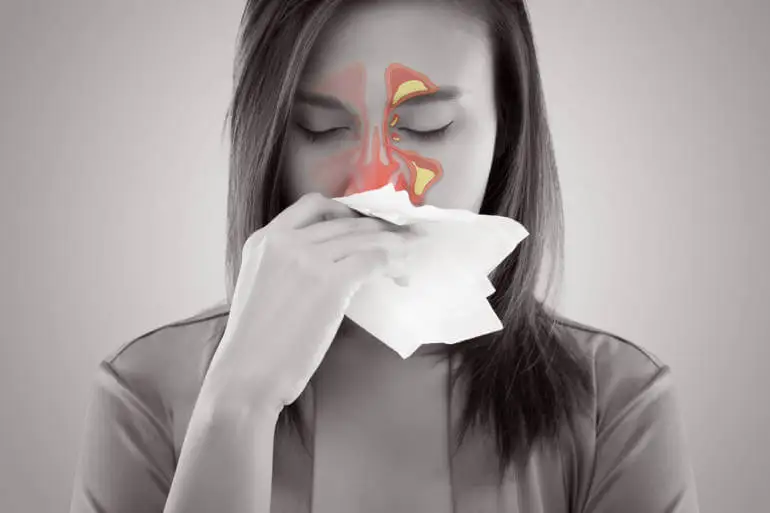 Mujer con sinusitis