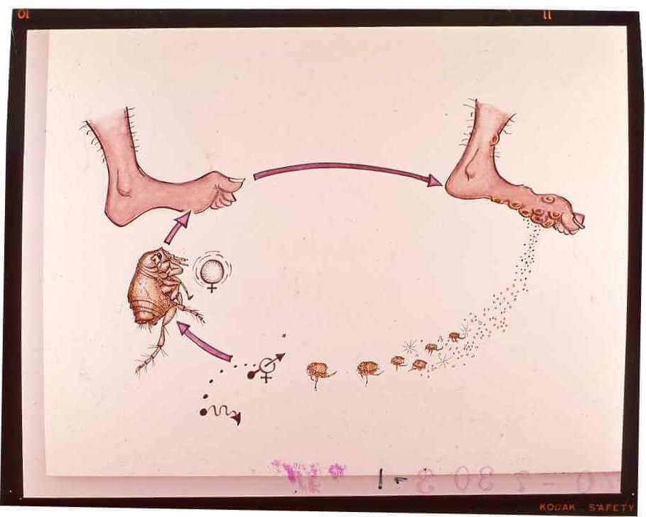 La tungiasis