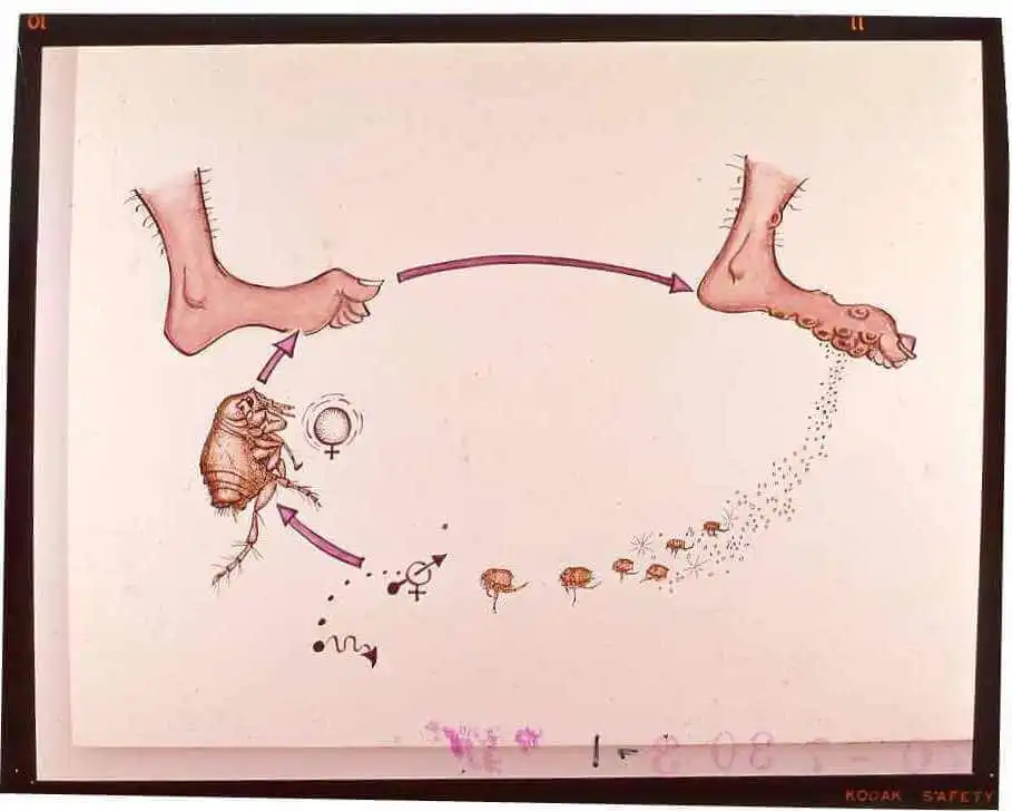 La tungiasis