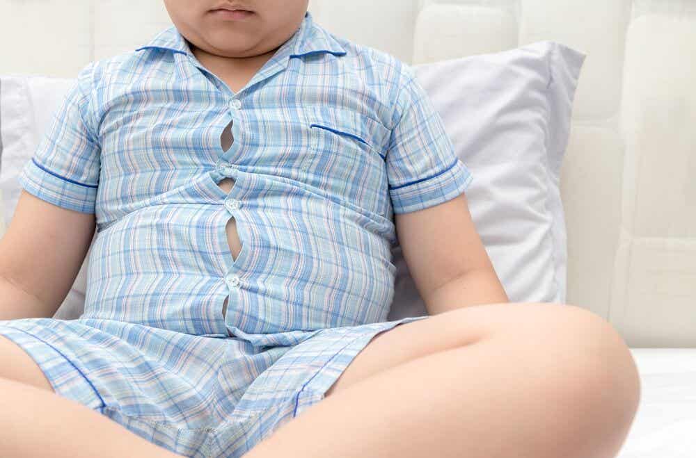 obesidad infantil y ginecomastia