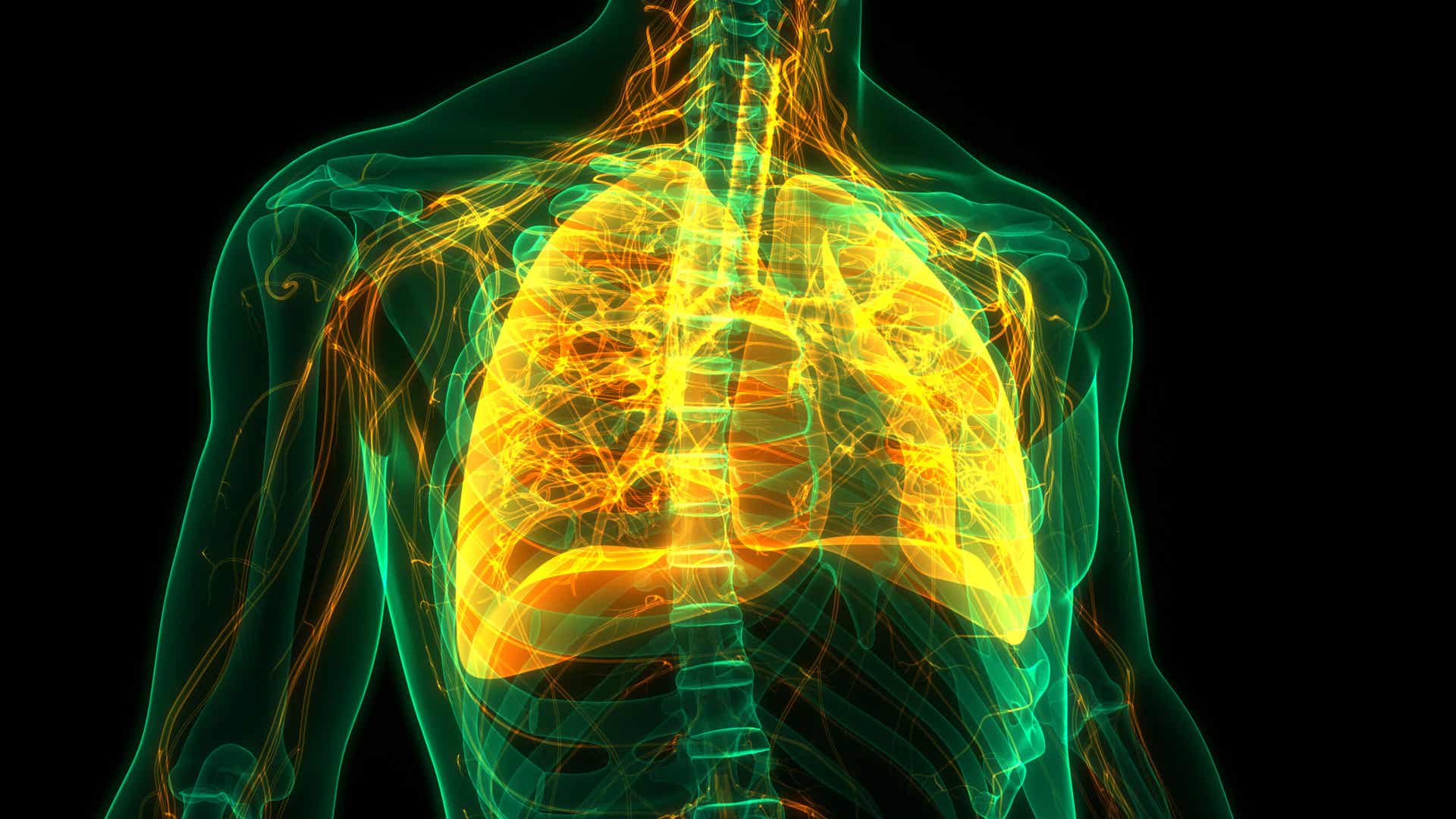 La sarcoidosis afecta pulmones.