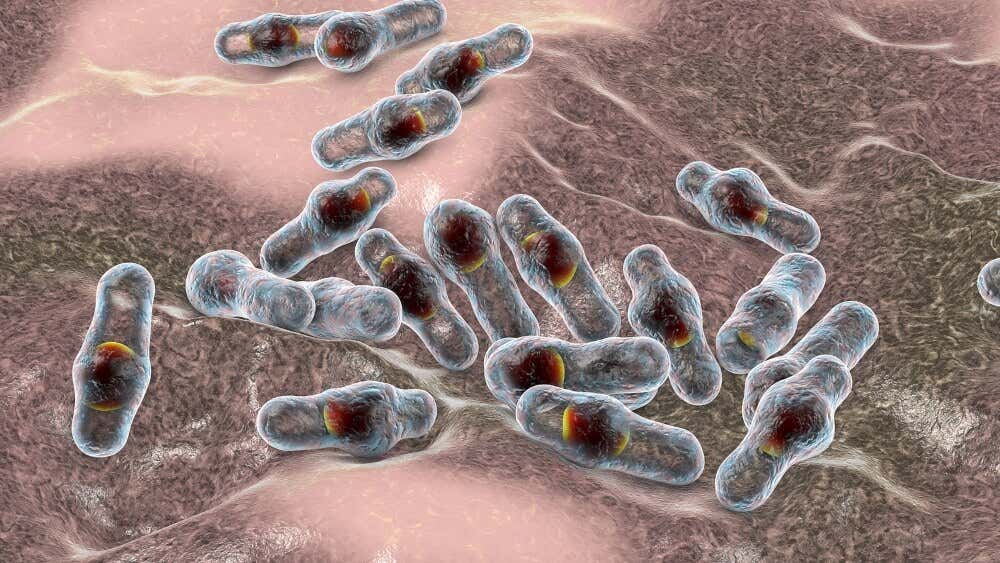 Bacteria que causa la gangrena.