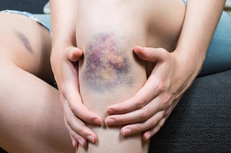 10 síntomas de cáncer que muchos ignoran
