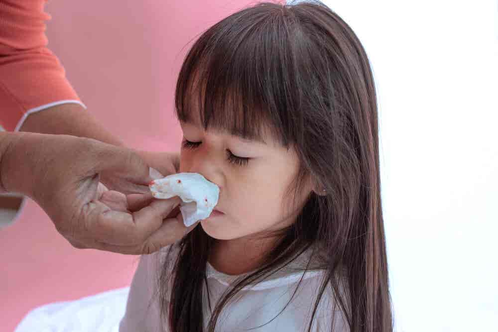 Hemorragias nasales en niños