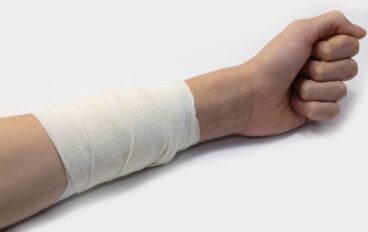 Primeros auxilios para una quemadura superficial