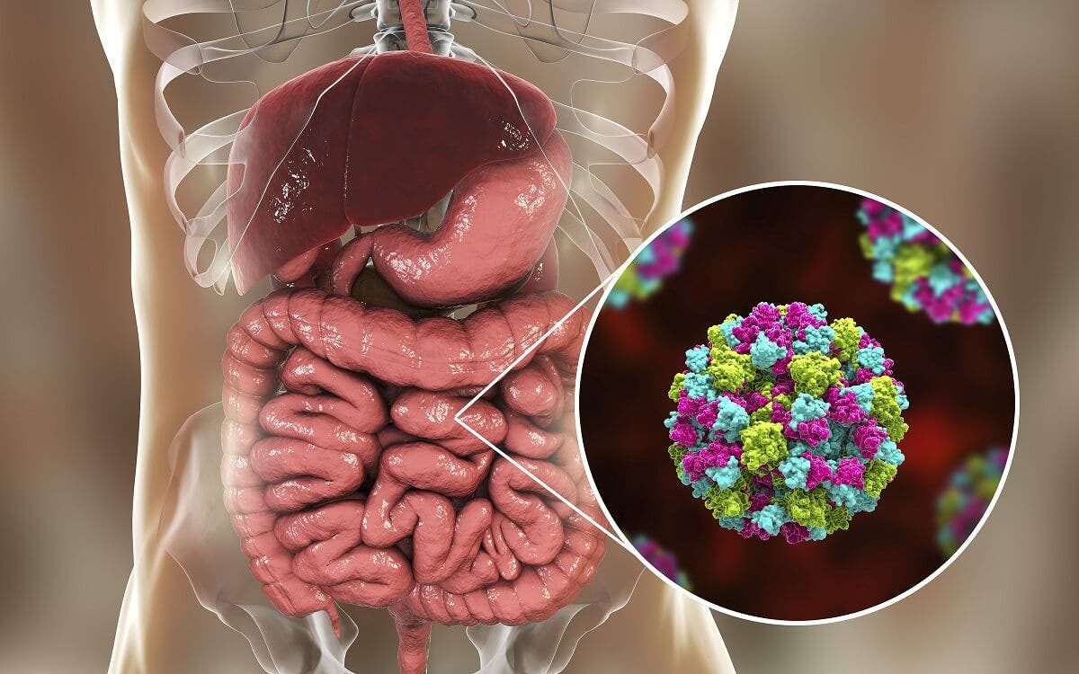 Sufrir de gastroenteritis es difícil.