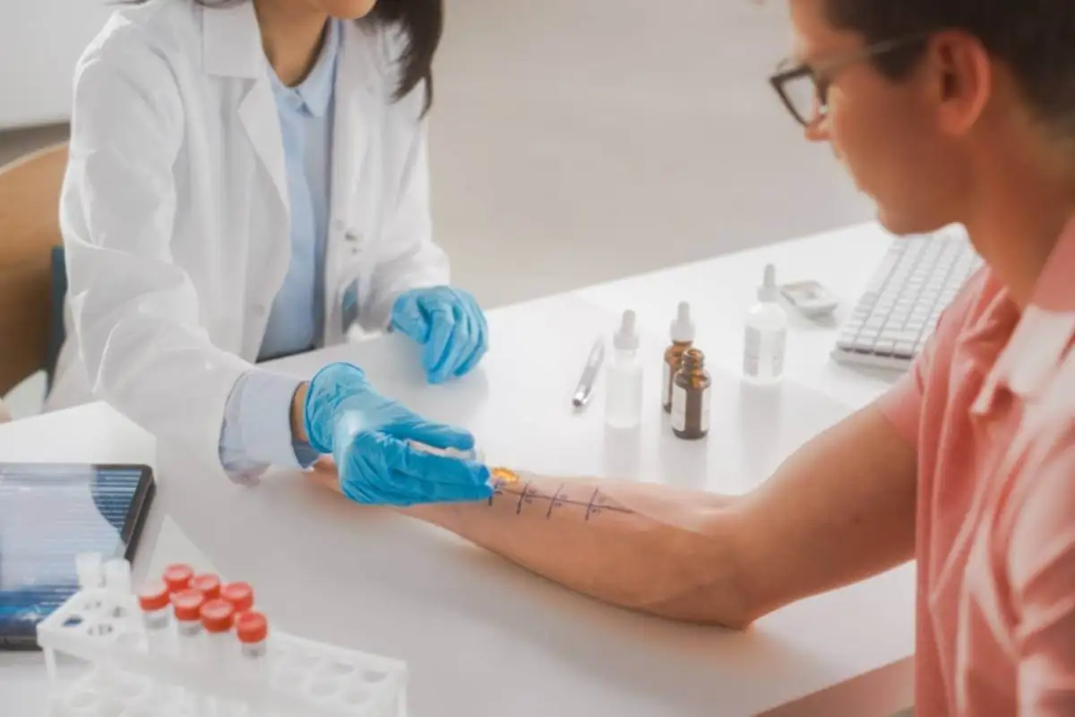 Médico realizando las pruebas de alergia a un paciente.
