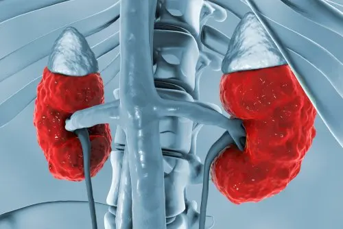 riñones enfermedad renal