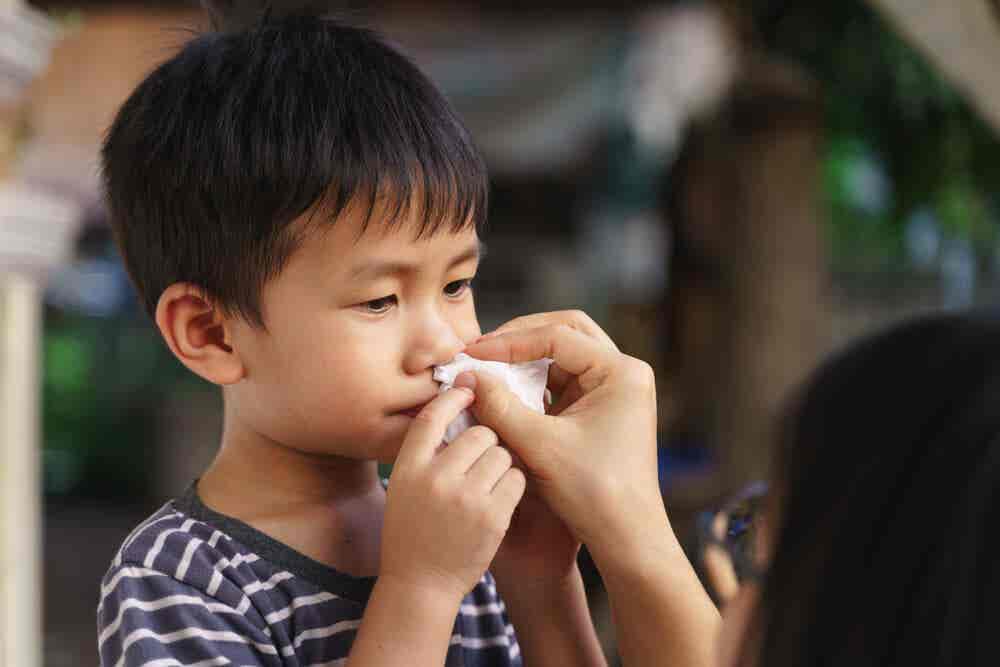 Sangrado nasal en niños