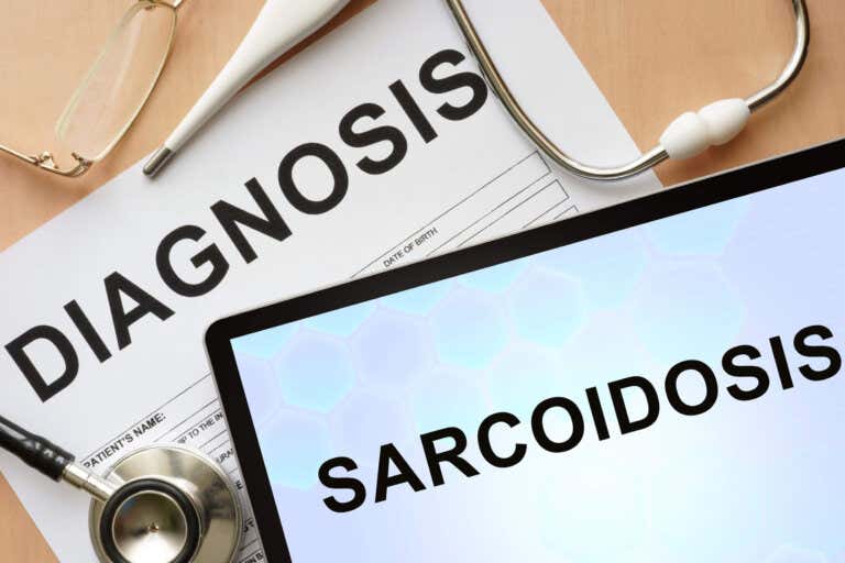 Qué es la sarcoidosis: síntomas y tratamientos