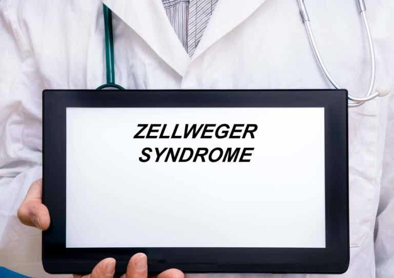 Lo que debes saber sobre el síndrome de Zellweger