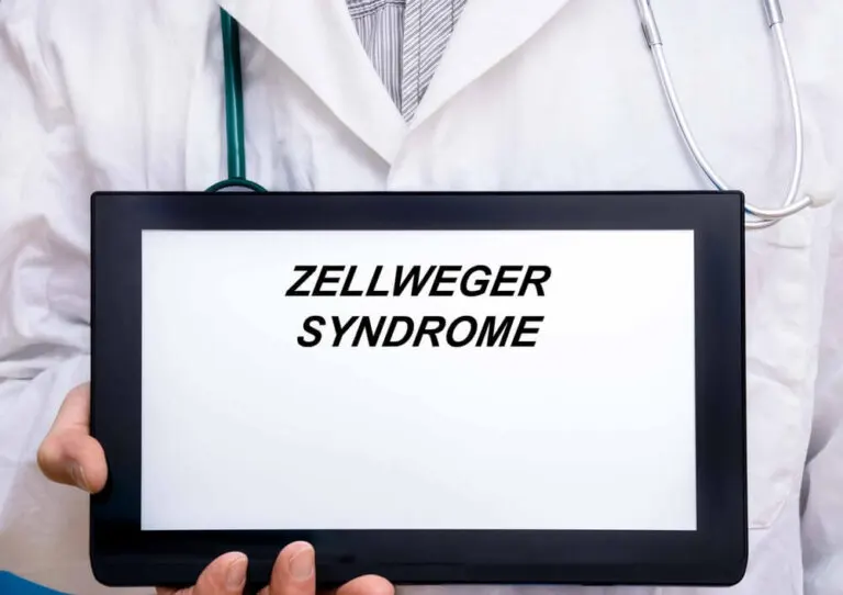 Lo que debes saber sobre el síndrome de Zellweger