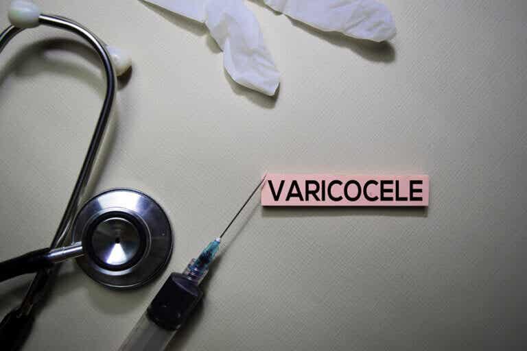 Complicaciones del varicocele: lo que debes saber