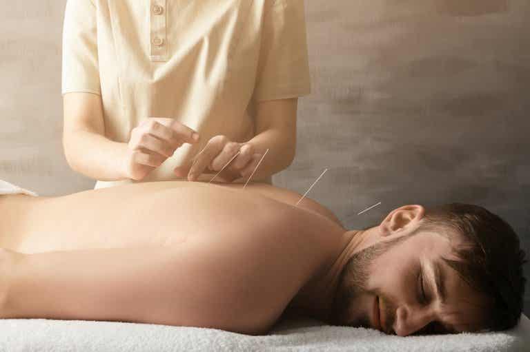 ¿Cómo ayuda la acupuntura a tratar el dolor articular?