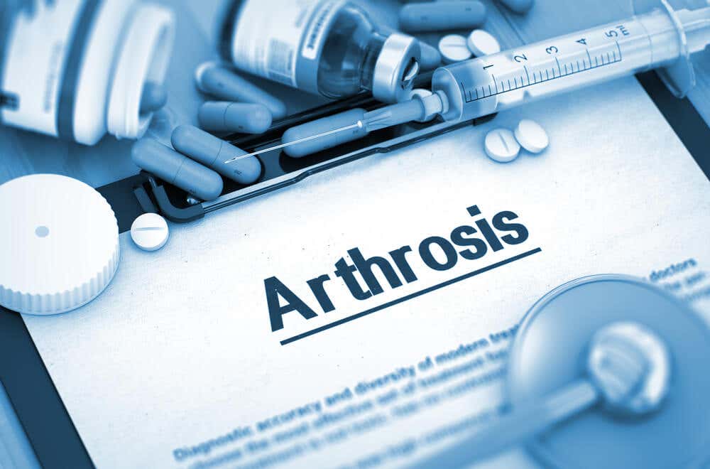 etoricoxib para la artrosis