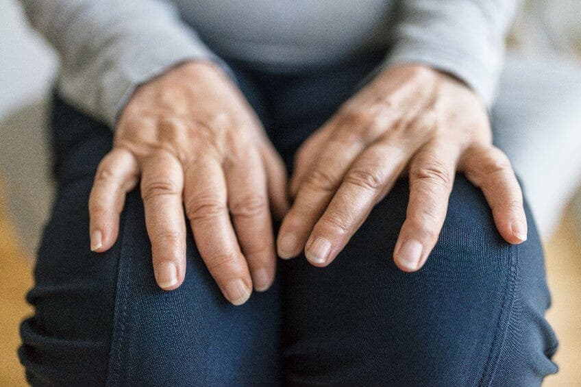 Paciente con artritis reumatoide.