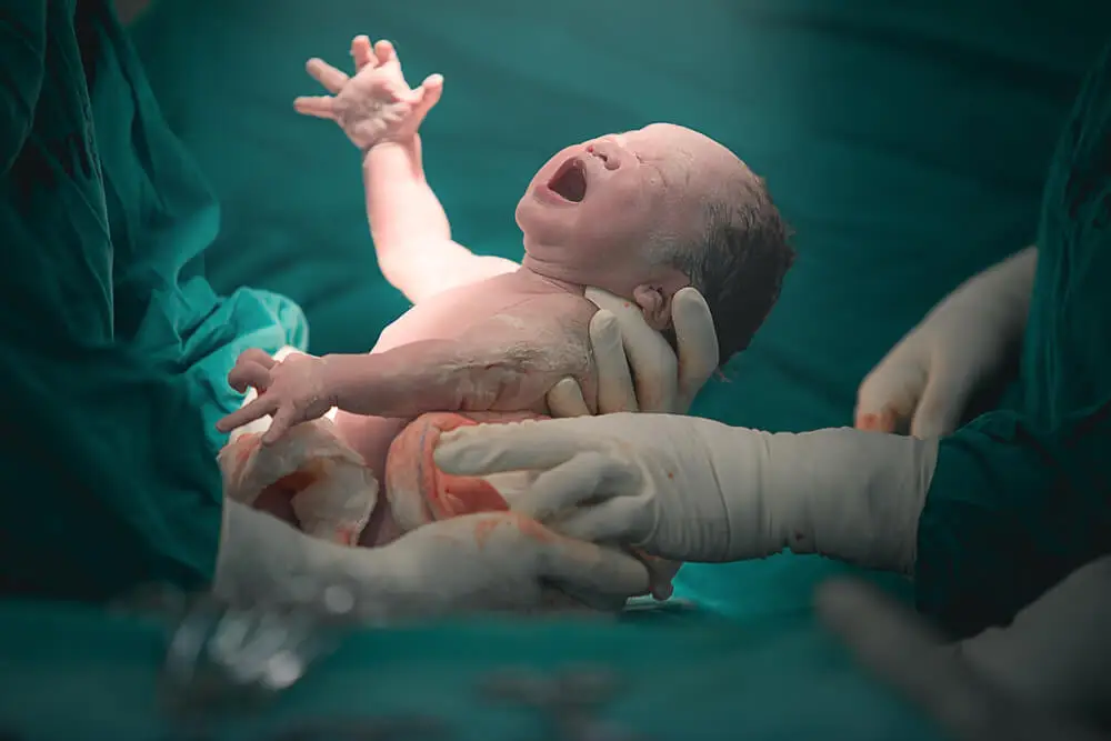 Factores de riesgo para el parto prematuro