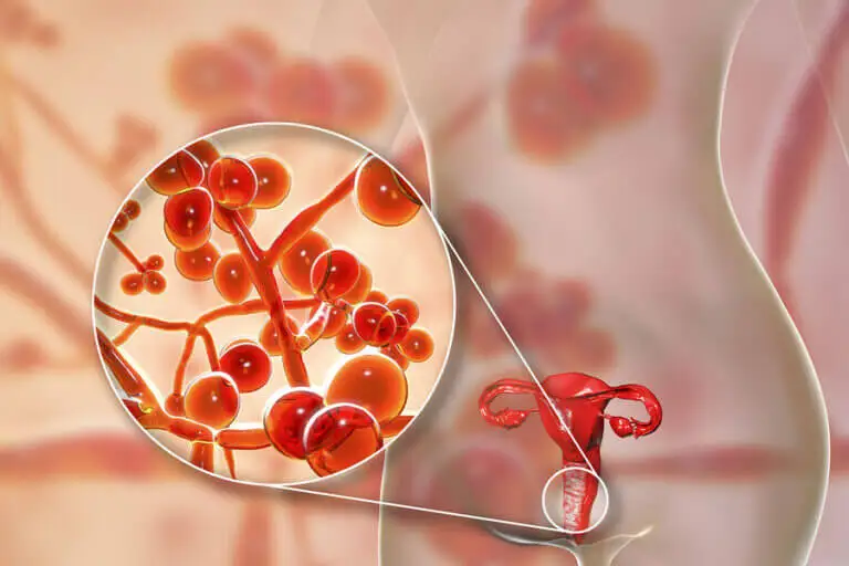 Micoplasma genital: causas, síntomas y tratamiento