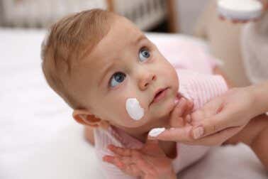 Tratamiento de la costra láctea y el acné neonatal