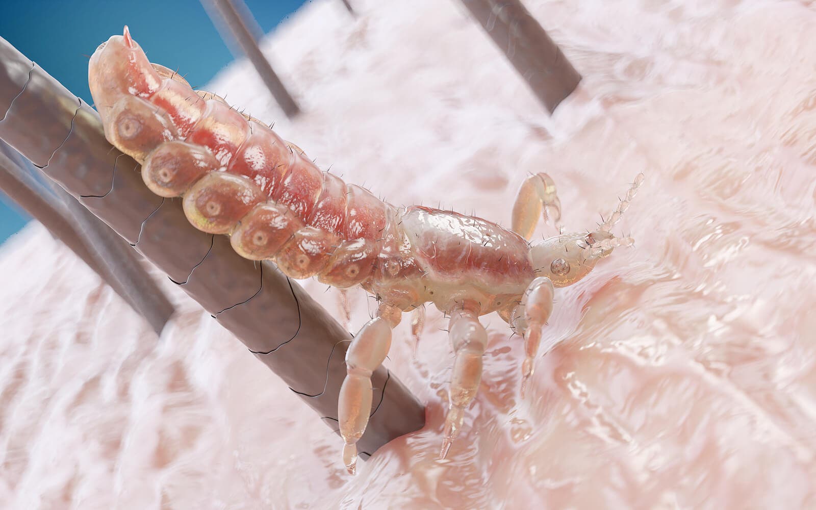 How to identify head lice.