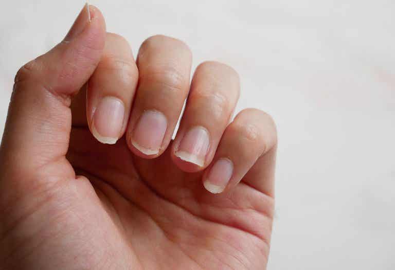 4 ingredientes naturales para tratar las uñas quebradizas