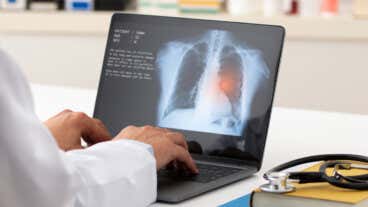 Edema pulmonar, ¿cuáles son sus síntomas y causas?