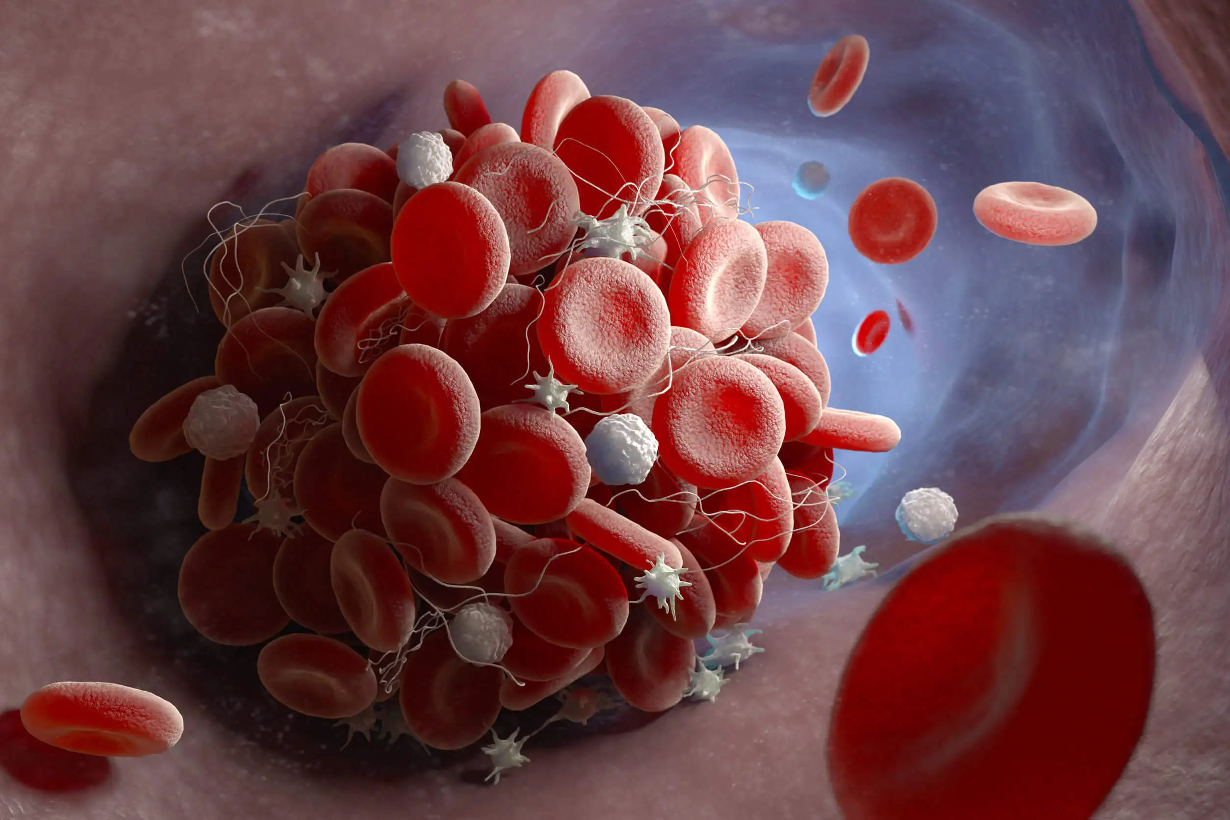 Coágulo de sangre en la equimosis