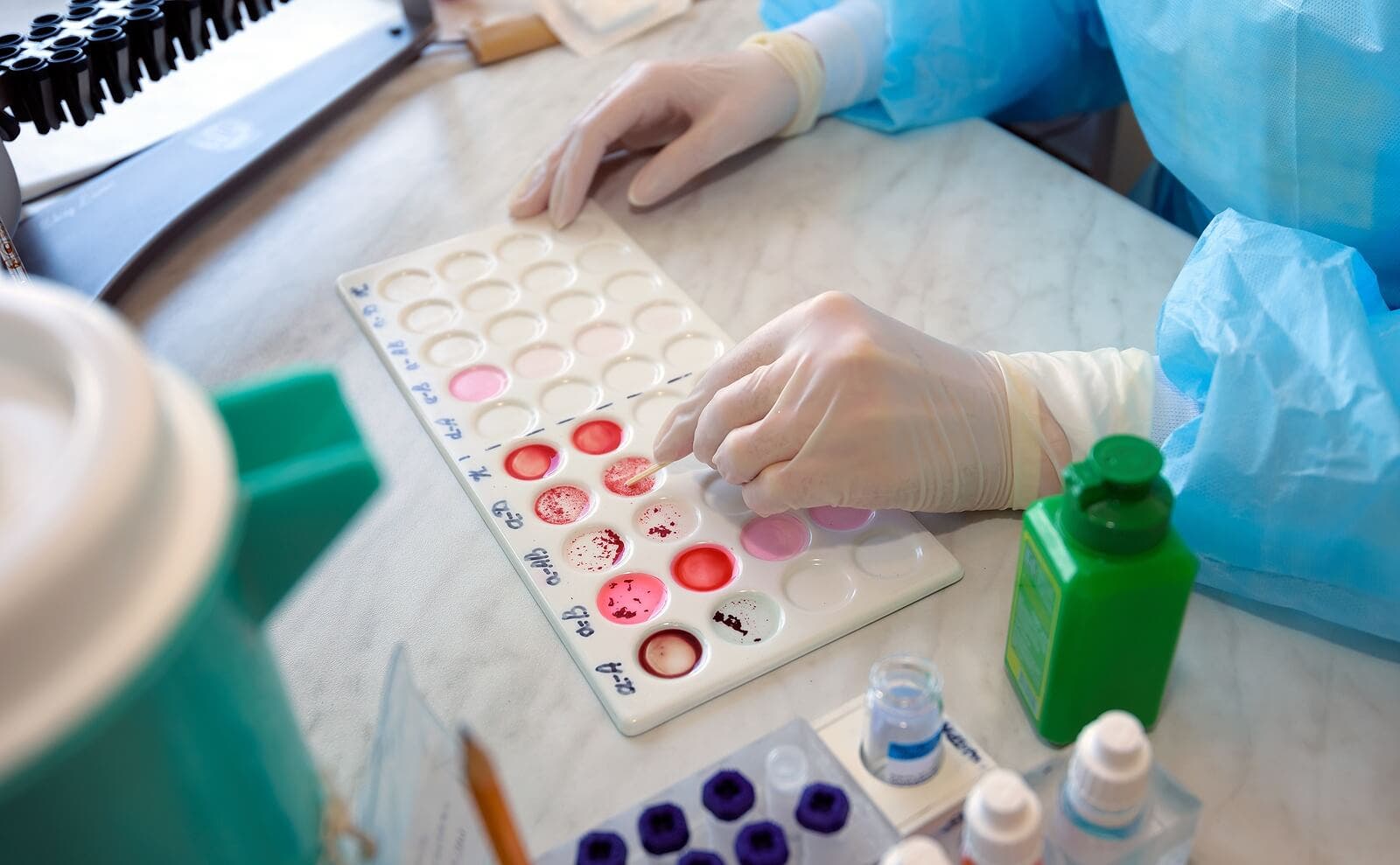 Prueba de laboratorio para esferocitosis hereditaria.
