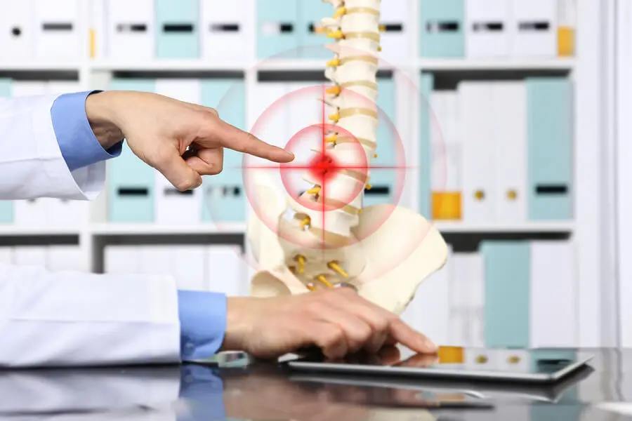 Médico señalando una hernia discal