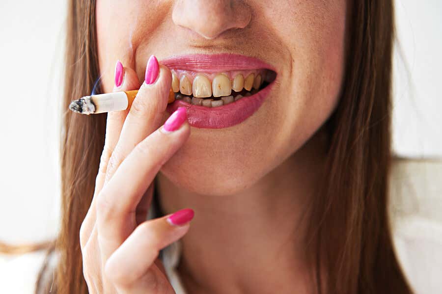Mujer que revela los perjuicios del tabaco en la cavidad oral