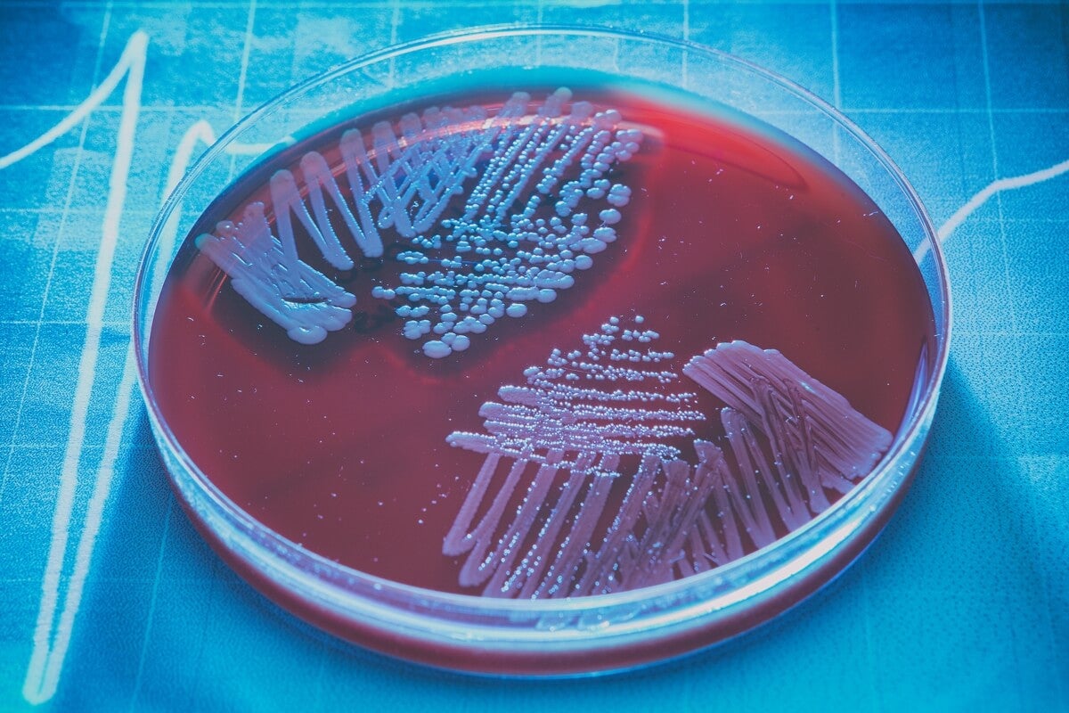 Bacterias atacadas por un extracto de nuez de tigre.