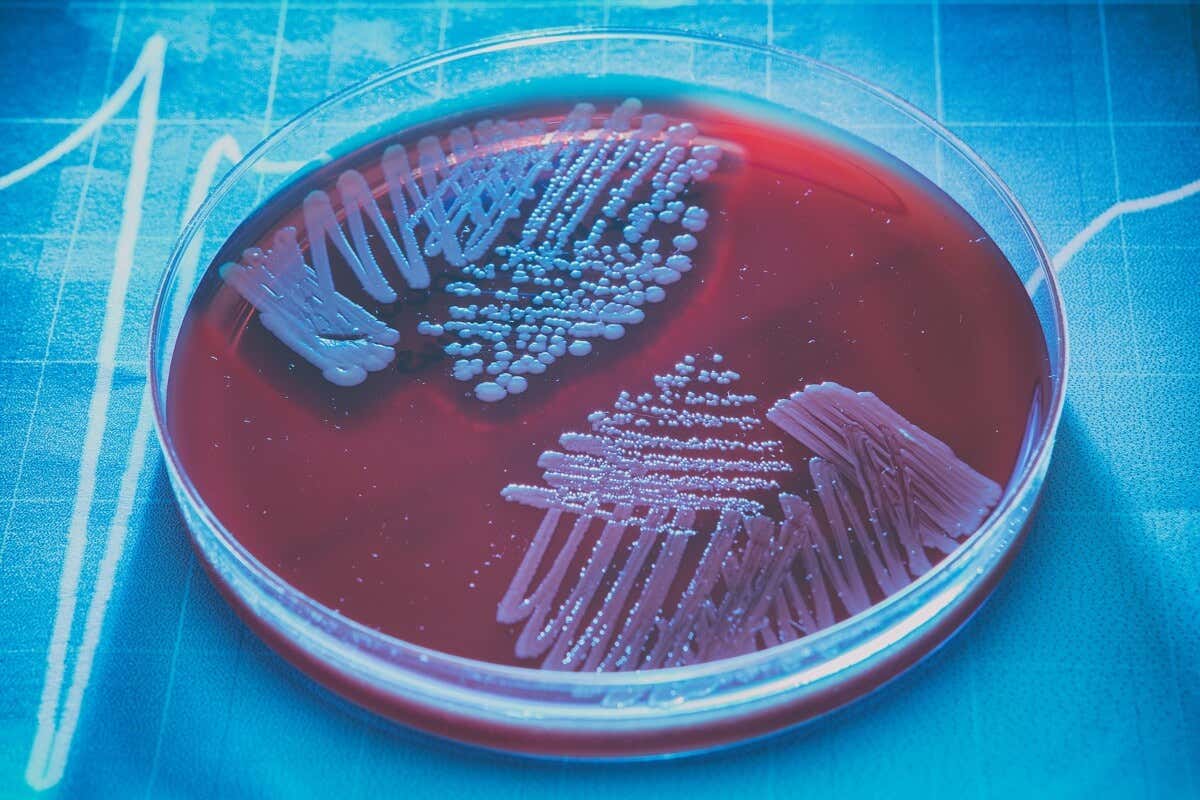 Bactéries attaquées par un extrait de souchet.