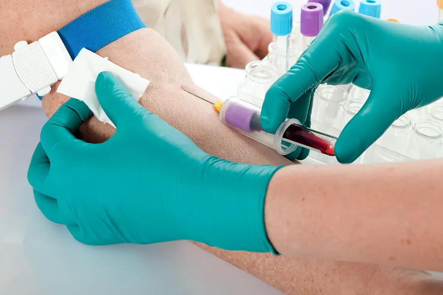 La hiperpotasemia: síntomas y tratamientos