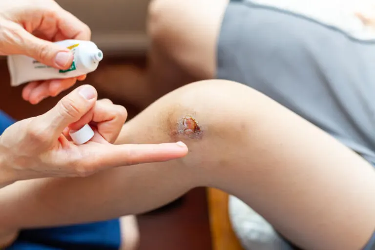 Retapamulina: indicaciones y eficacia