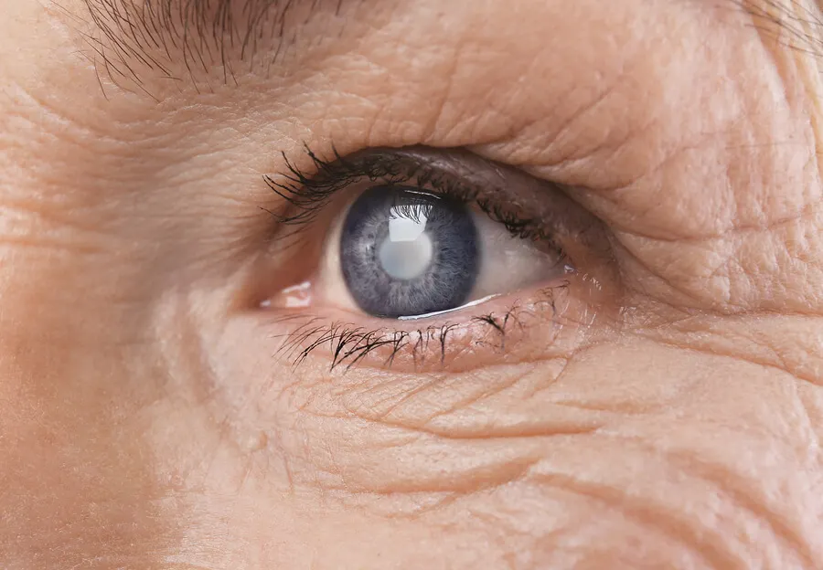 Retinopatía diabética