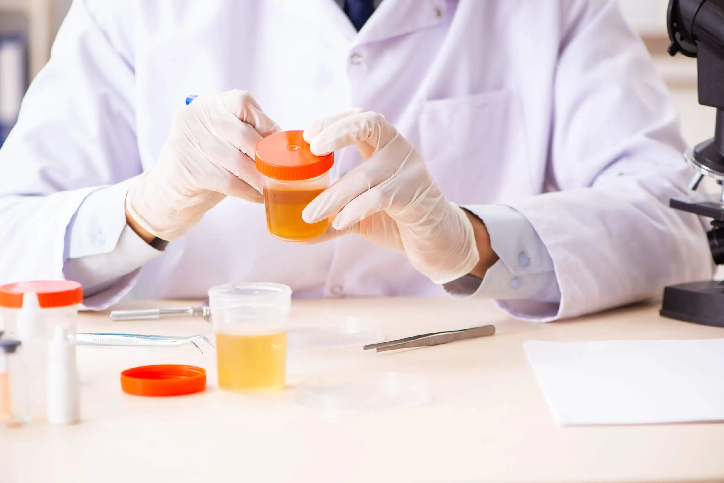 Las proteínas en la orina suelen detectarse con un uroanálisis.