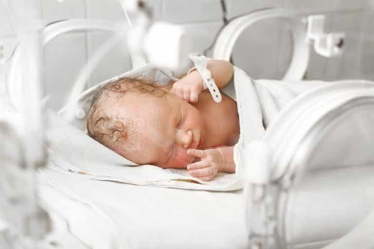 Gastrosquisis en recién nacidos