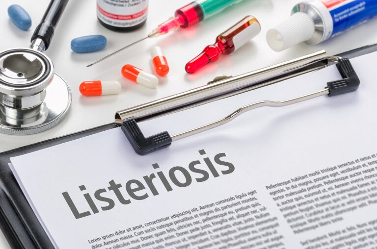 Listeriosis, ¿cómo se transmite y cómo prevenirla?