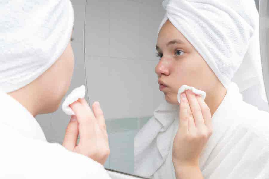 Eridosis para el acné: precauciones