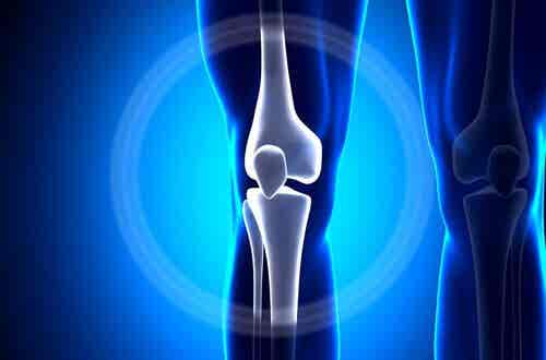 osteosarcoma de rodilla