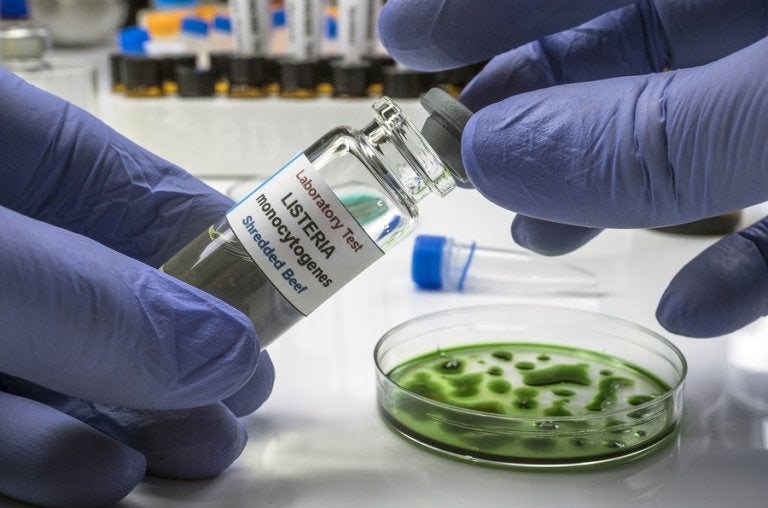 Cómo afecta la listeria al embarazo