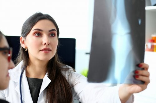 Osteosarcoma, ¿qué es y cómo se trata?