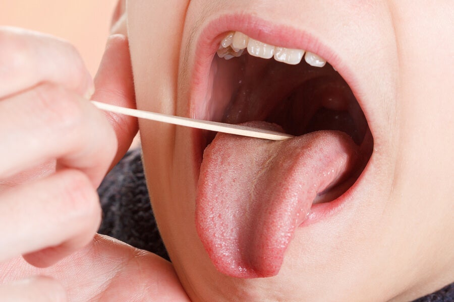 de madera Isaac Cálculo Placas en la garganta: síntomas y tratamiento - Mejor con Salud