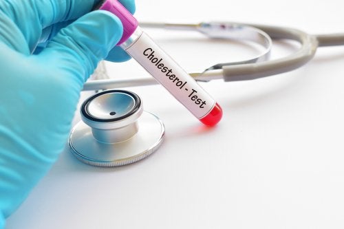 ¿Cuál es el nivel adecuado de colesterol?