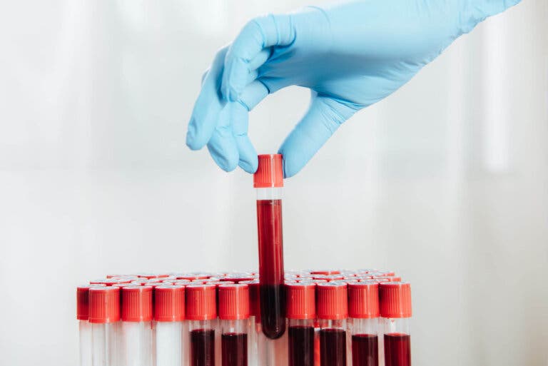 ¿Cada cuánto tiempo hay que hacerse un análisis de sangre?