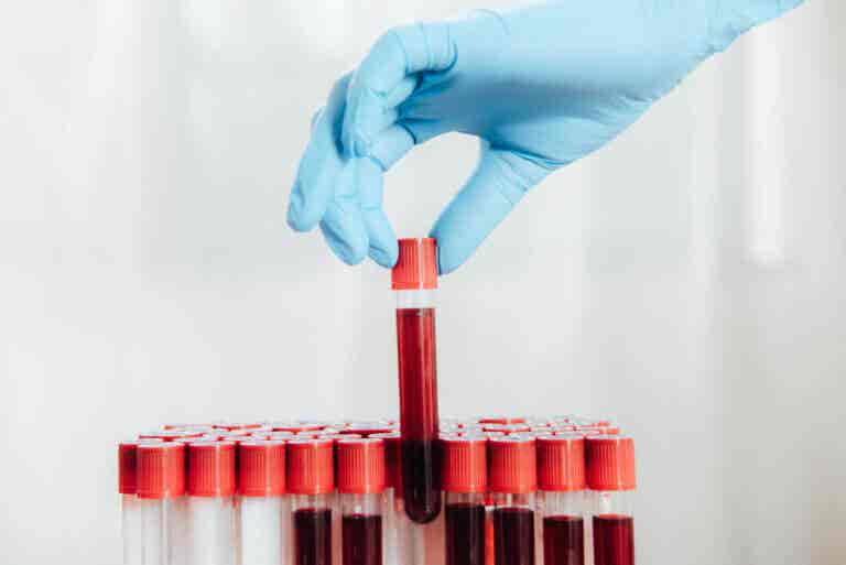 ¿Cada cuánto tiempo hay que hacerse un análisis de sangre?