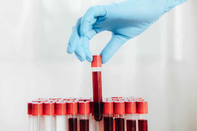 ¿Cada cuánto tiempo hay que hacerse un análisis de sangre?