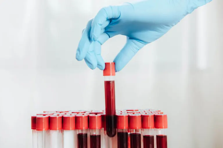 ¿Cada cuánto tiempo hay que hacerse un análisis de sangre?