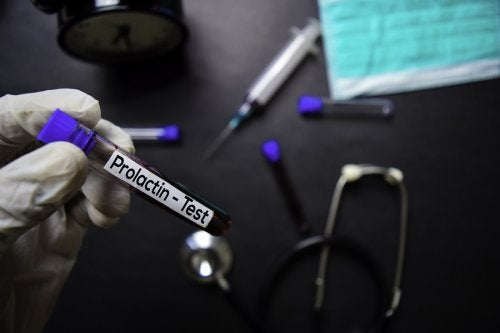 Valores normales de prolactina y por qué puede alterarse