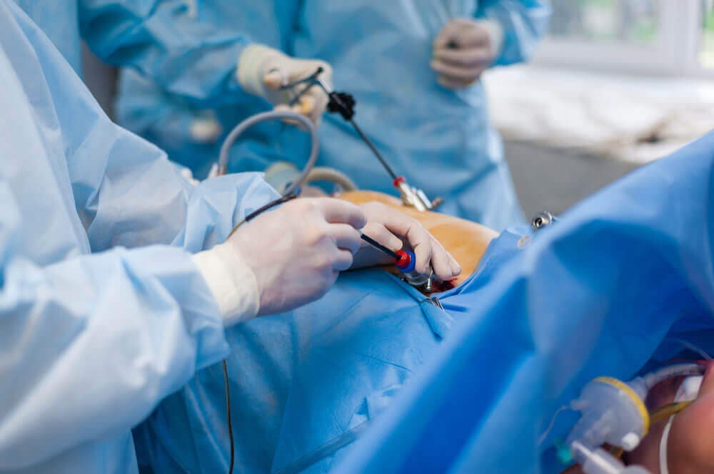 Colostomía